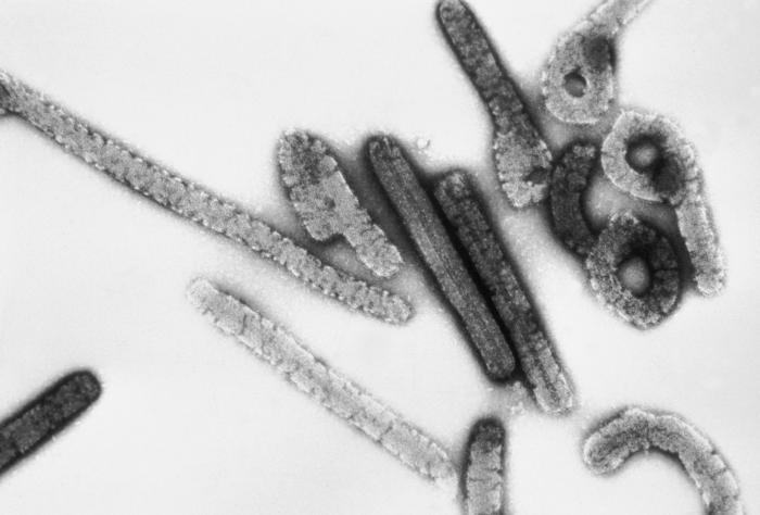 WHO reports deadly Marburg virus cases in Africa while monkeypox has already reached 10,000 1
