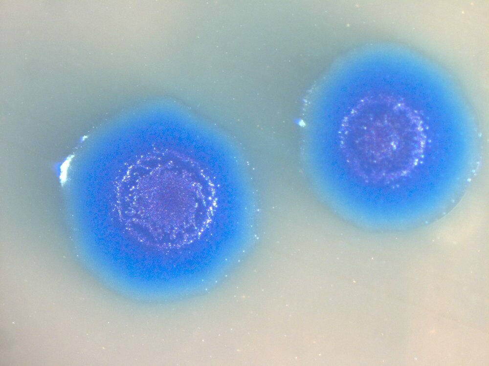 Project Cynthia: A Bacteria Named "Death"