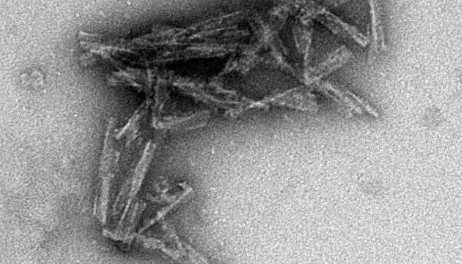 Prionen: Sie steigen aus dem Nichts auf und verwandeln Menschen in zombieähnliche Kreaturen. Die Sterblichkeitsrate liegt bei 100 %, es gibt keine Heilung für sie 11 Gereinigte infektiöse Prionproteine, zusammengesetzt zu stäbchenförmigen Strukturen