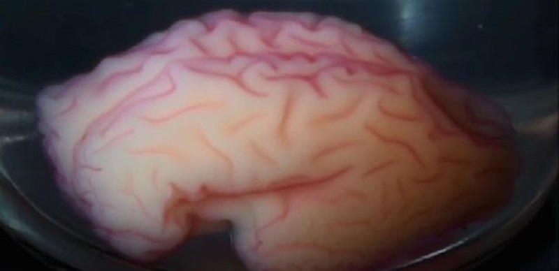 Biologen haben zum ersten Mal funktionierendes Gehirngewebe in 3D gedruckt. Vollgas für Kopftransplantationen? 1