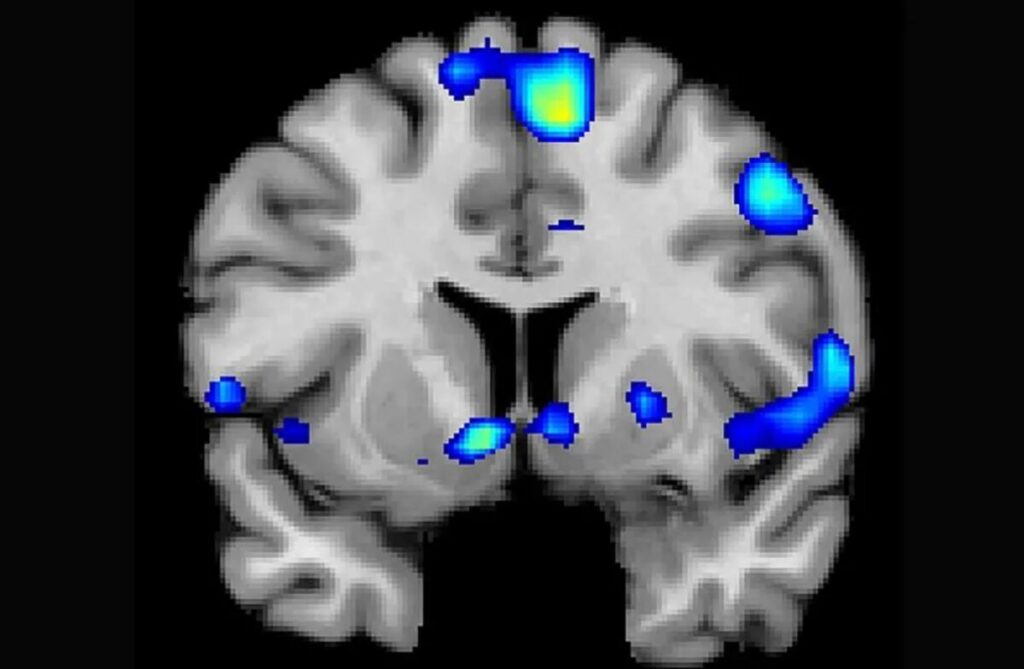 Scientists have uncovered another phenomenon in the study of prayer's impact on the human brain 3