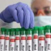 The Avian Influenza Summit is significant! Could it lead to a situation similar to the COVID pandemic? 30