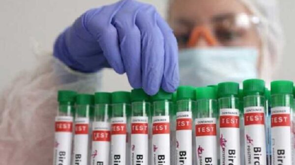 The Avian Influenza Summit is significant! Could it lead to a situation similar to the COVID pandemic? 29